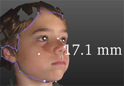 3-Dimensional Facial Analysis—Facing Precision Public Health